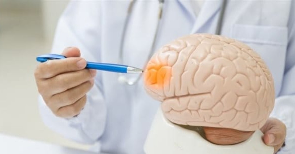 رئيس جمعية طبّ الأعصاب بالقطاع الخاص بصفاقس: هذه أبرز أسباب وأعراض الجلطة الدماغية